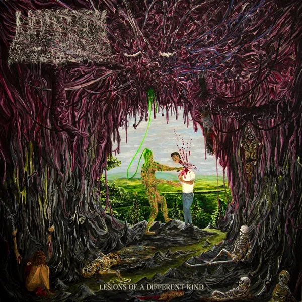 Undeath - Lesions Of A Different Kind (LP, slime green vinyl)